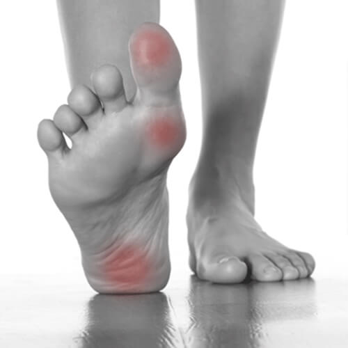 Foot Pain